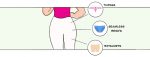 what type of panty should you wear