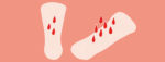 What’s The Difference Between Periods And Spotting?