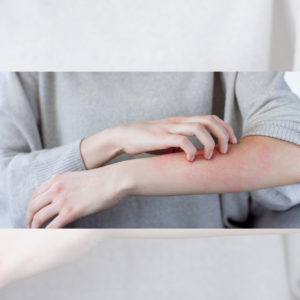 Avoid Scratching