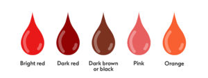 Period Blood color