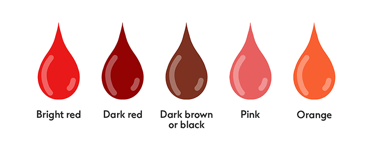 Clues In The Hue: What Does The Colour Of Your Period Blood Mean?