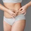 How to Get Rid of Stretch Marks?