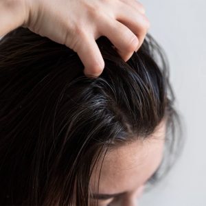 Oily Hair Should Be Washed More Often Or Even Daily