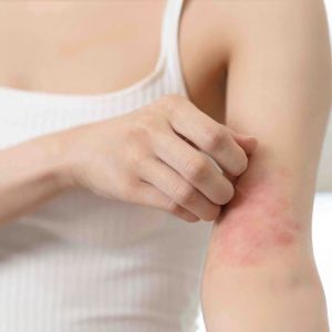 Skin problem